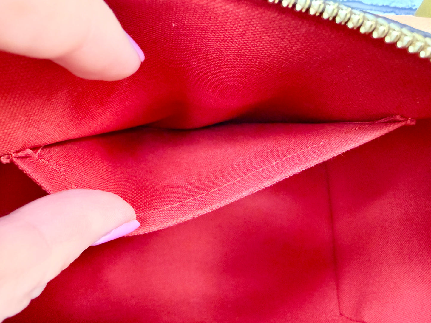 Louis Vuitton Monogram Speedy 20 (Black)